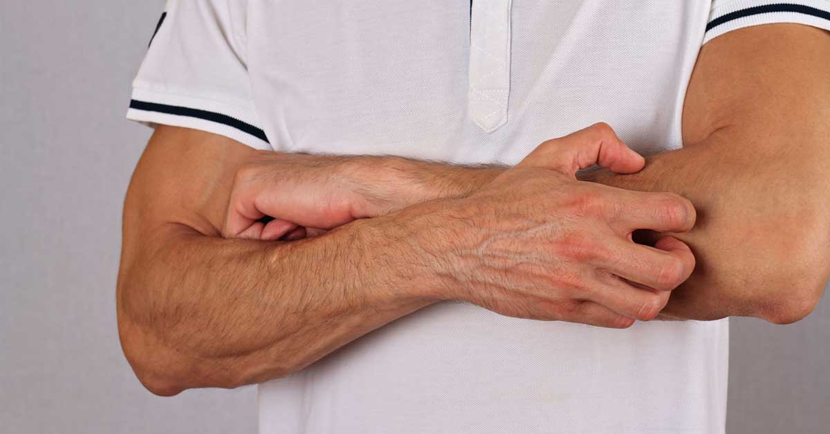 A Natural Treatment for Eczema that Won’t Go Away Bottom Line Inc