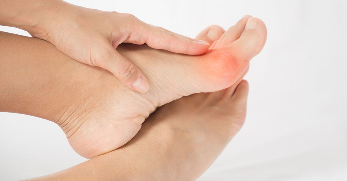 Why Is My Bunion Growing So Fast? Bottom Line Inc