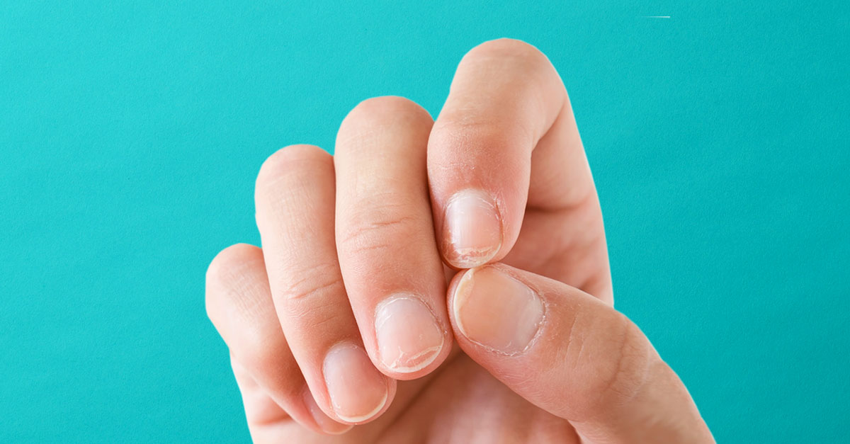 What Do Your Nails Say About Your Health? Bottom Line Inc